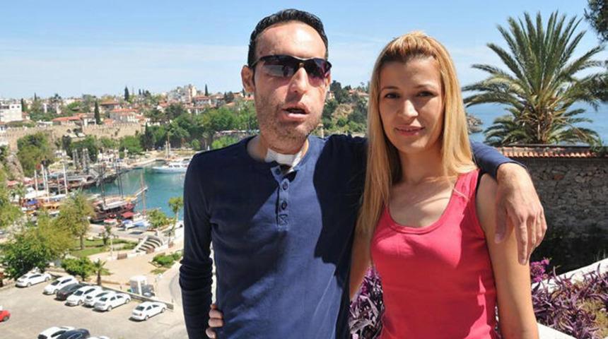 Y&uuml;z nakilli Recep Sert ile eşi Esma Sert'ten ayrılık kararı