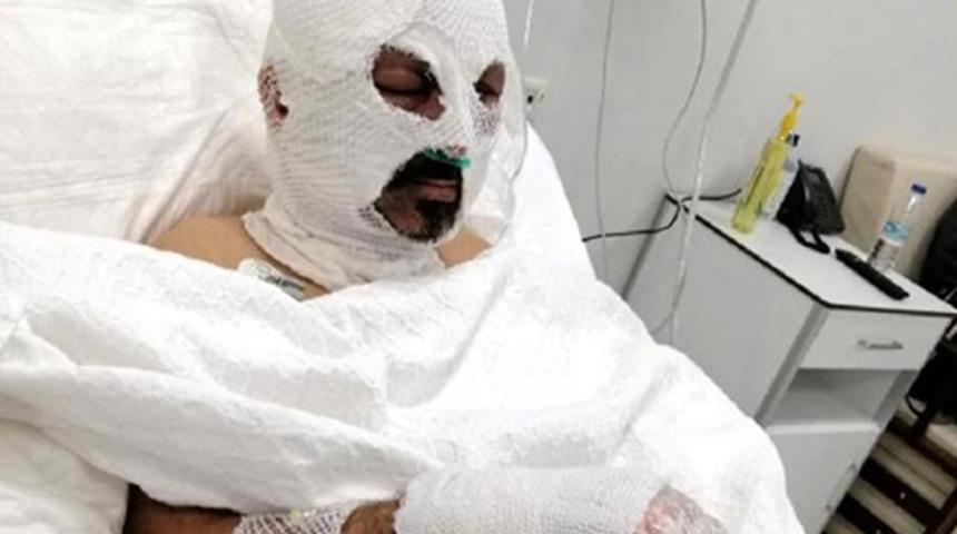 Zonguldak'ta dehşete d&uuml;ş&uuml;ren olay! Tiner d&ouml;k&uuml;p yaktı