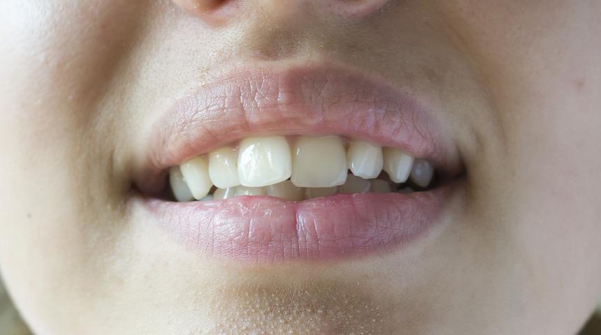 Çapraşık diş tedavisi neden önemli?