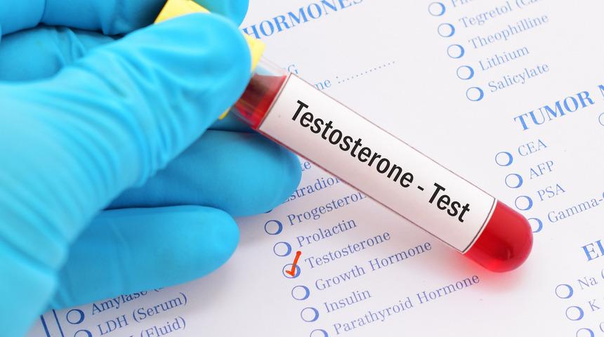 Testosteron düşüklüğü nedir? Testosteron düşüklüğü kısırlık nedeni mi?