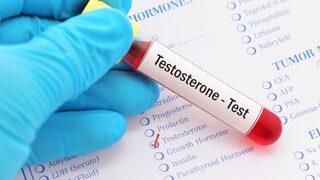 Testosteron düşüklüğü nedir? Testosteron düşüklüğü kısırlık nedeni mi?