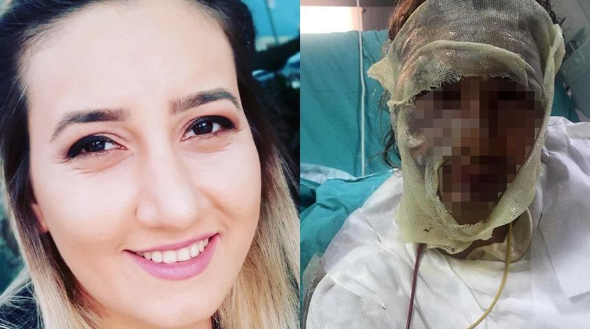 "Kızgın yağla yüzümü yaktı" demişti, mahkemede 'yalan söyledim' dedi