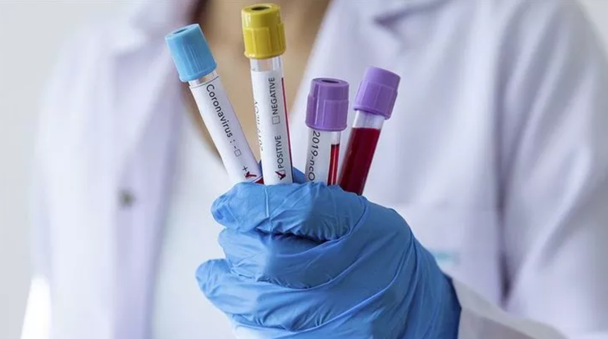 &Ccedil;in&rsquo;de Kovid-19 (koronavir&uuml;s) salgınında can kaybı 2 bin 665&rsquo;e &ccedil;ıktı