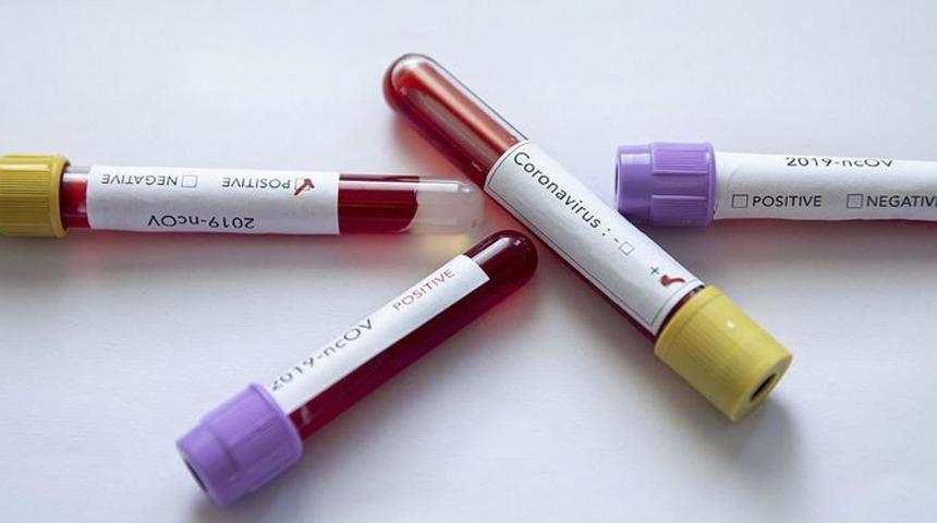 Kanarya Adaları'nda bir otel koronavir&uuml;s nedeniyle karantinaya alındı