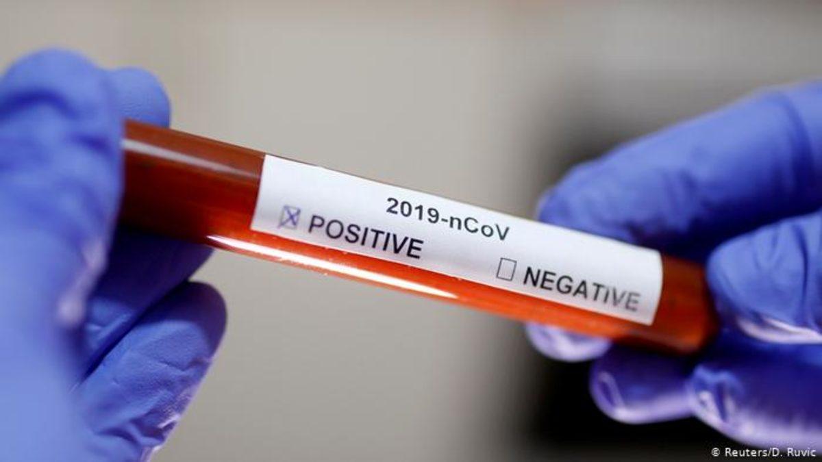 Koronavirüs kabusu büyüyor! ABD'de koronavirüsten ilk ölüm