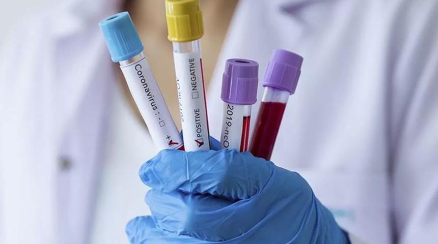 Koronavirüs tehlikesi Google çalışanlarına sıçradı!