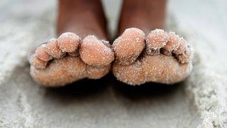 Cilt kanseri belirtilerine dikkat! Herkes bu 10 noktayı kontrol etmeyi unutuyor