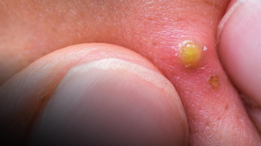 Zarar veren günlük alışkanlıklar! Tehlikeli olduğunu bilmeden yapmaya devam ediyoruz