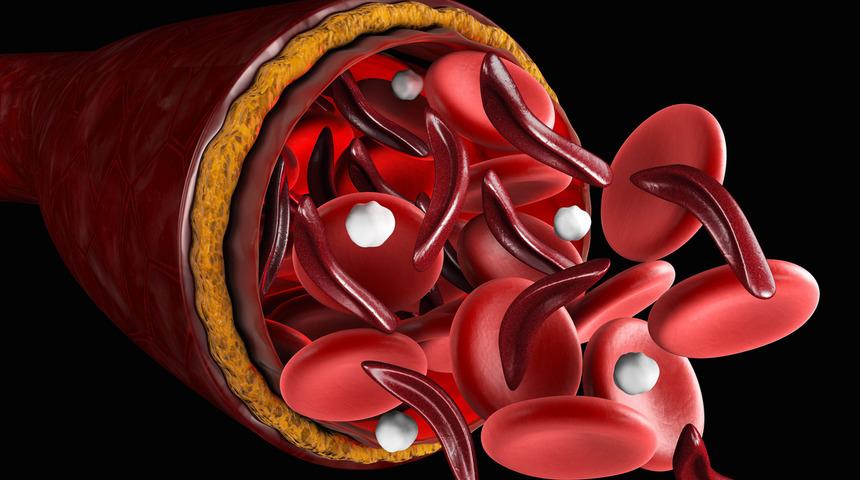 Demir eksikliğine ne iyi gelir diyenler için C vitamini önerisi