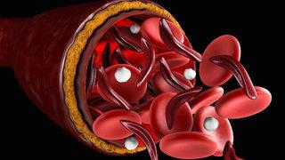 Demir eksikliğine ne iyi gelir diyenler için C vitamini önerisi