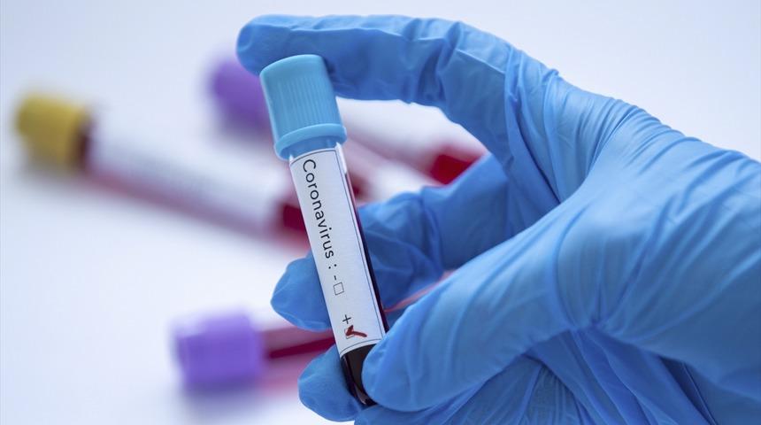 Araştırıldı incelendi: WeChat Koronavirüs'ü sansürlüyor!