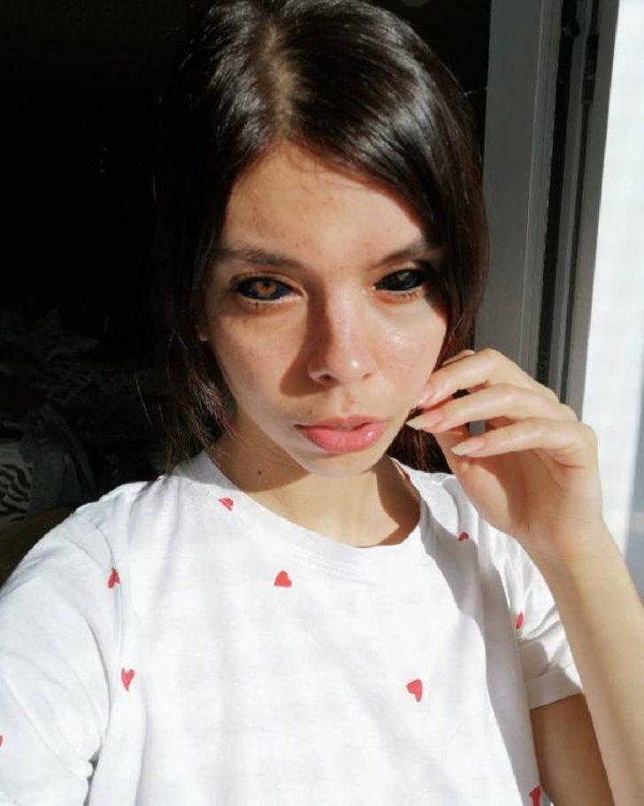 Korkunç! Gözünün içini siyaha boyattı G5