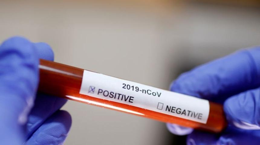 Koronavir&uuml;s nedir, nasıl bulaşır, belirtileri nelerdir? Sağlık Bakanlığı'ndan yeni bilgilendirme