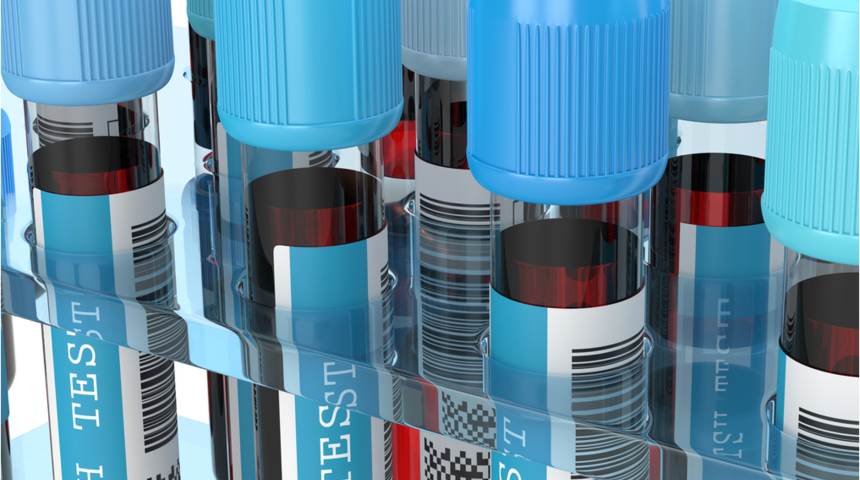 TSH yüksekliği nedir, nasıl düşürülür? Regl dönemi bile etkiliyor! 