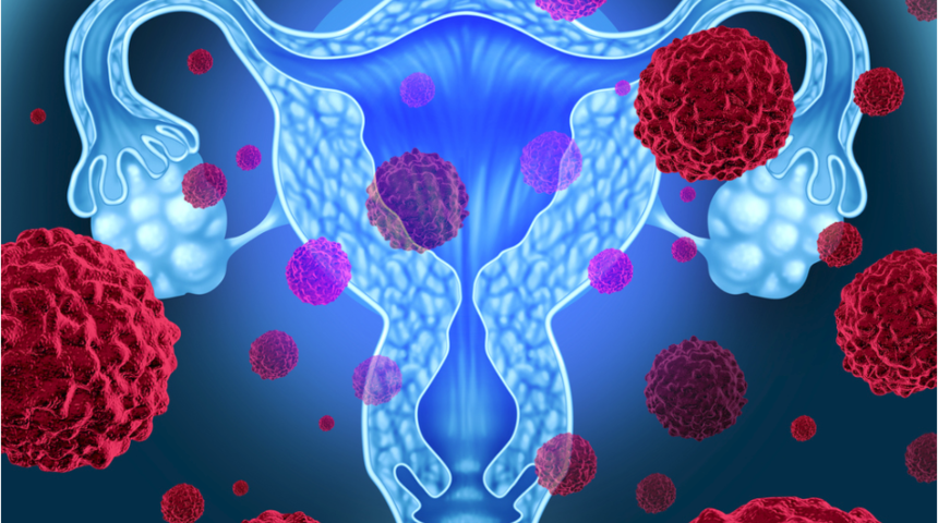 Rahim kanseri belirtileri nelerdir, nasıl anlaşılır? En &ouml;nemli belirtiye dikkat!