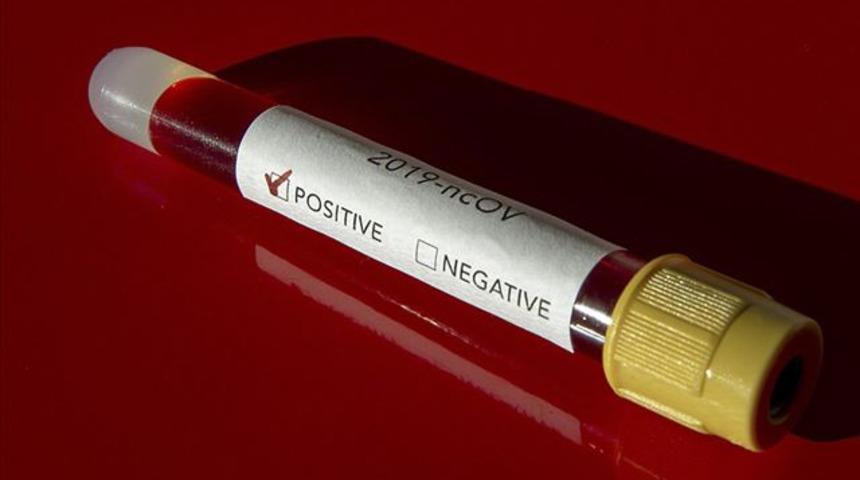 Koronavir&uuml;s Portekiz'de de g&ouml;r&uuml;ld&uuml;