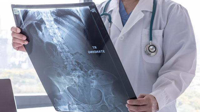 Dalak büyümesi neden olur? Dalak büyümesi yaşayan hasta hemen tedavi edildi