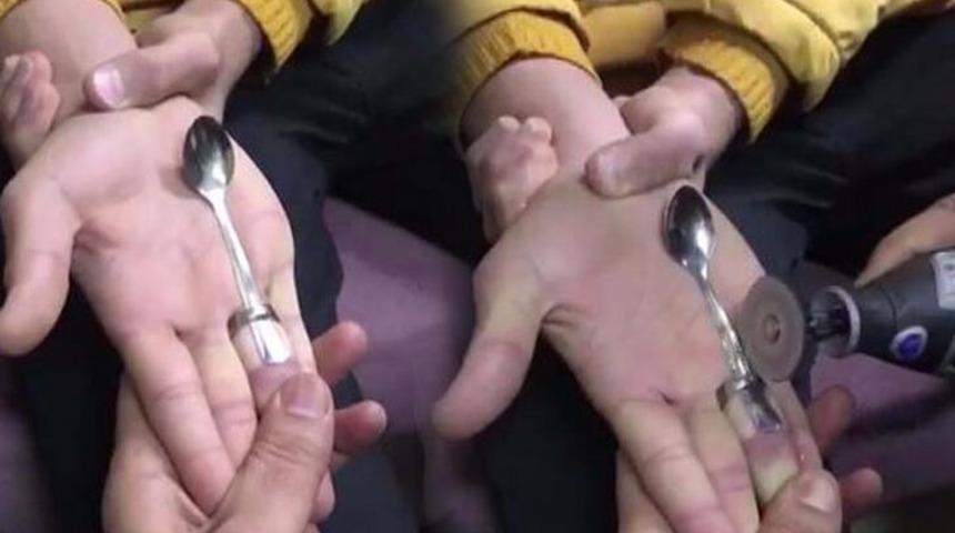 Parmağında yüzük sıkıştı, ispiral makinesiyle kesildi!