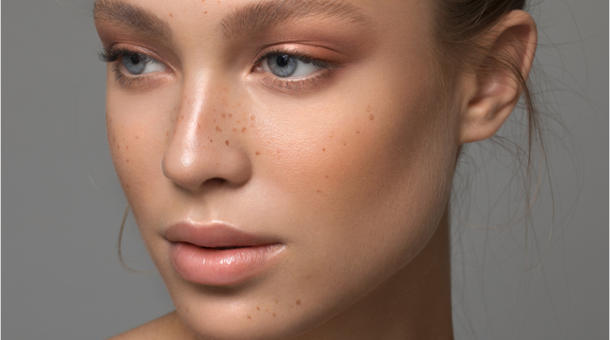 Daha kadınsı yüz hatları Masseter Botoks ile mümkün