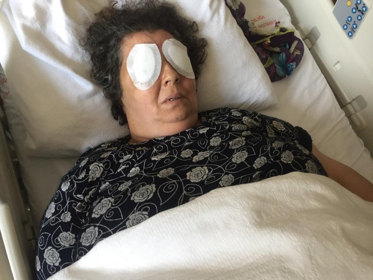 Adana'daki hastanede dehşet! Kadın hastanın g&ouml;zlerini &ccedil;ıkardı