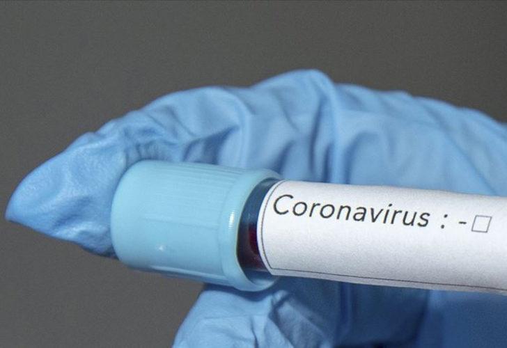 Sırbistan'da ilk koronavirüs ölümü