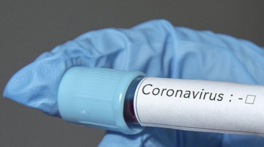 Panama'da ilk koronavirüs vakası tespit edidi