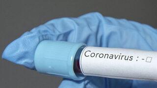 Panama'da ilk koronavirüs vakası tespit edidi