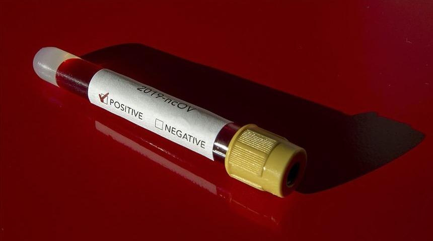 ABD'de koronavir&uuml;sten &ouml;lenlerin sayısı 17'e y&uuml;kseldi