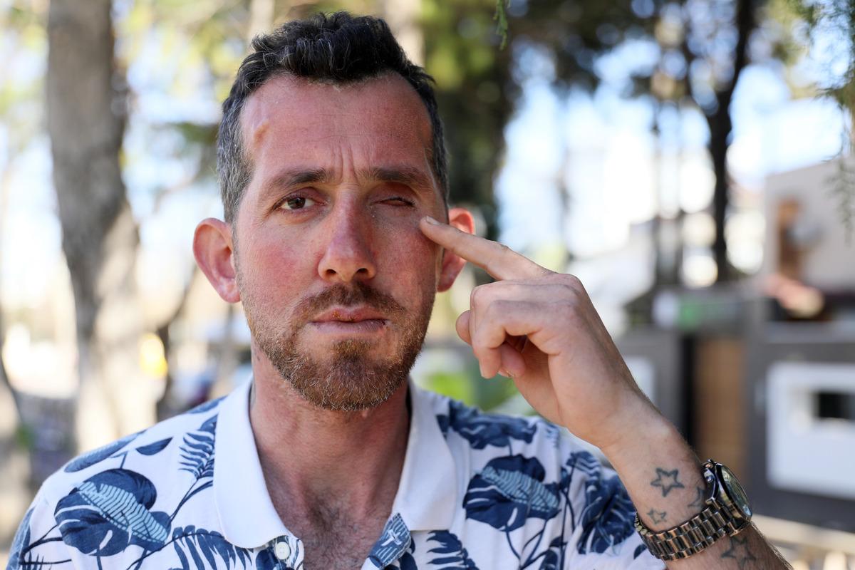 'Bilye atar' tabancayla vuruldu! Fırıncı ustasının hayatı karardı