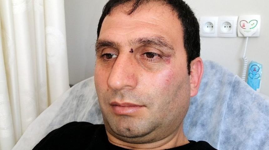 Erzincanspor y&ouml;neticileri gazeteciyi d&ouml;verek hastanelik etti