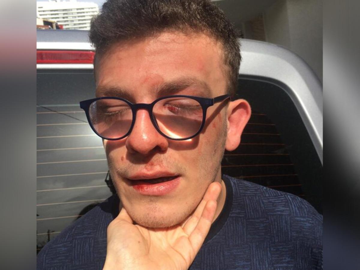 Avcılar'da bir kişi otizmli genci d&ouml;verek hastanelik etti