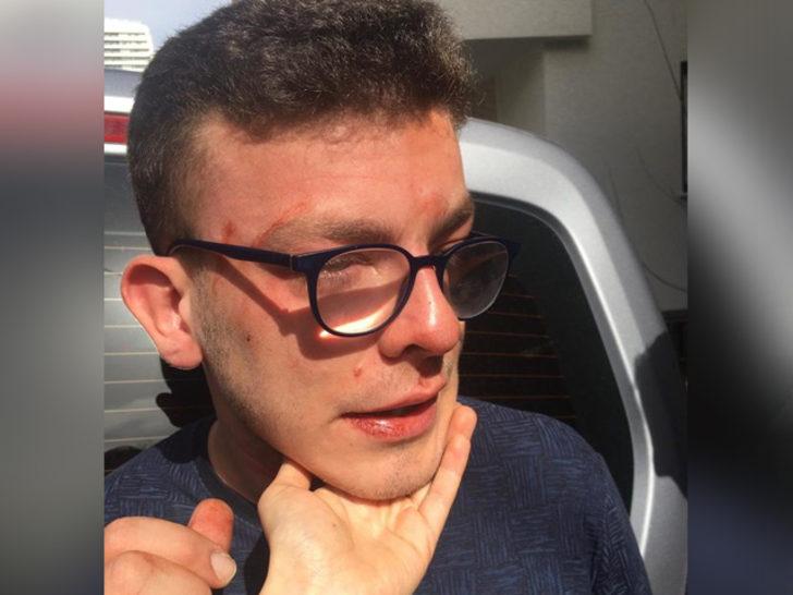 Avcılar'da bir kişi otizmli genci döverek hastanelik etti G2