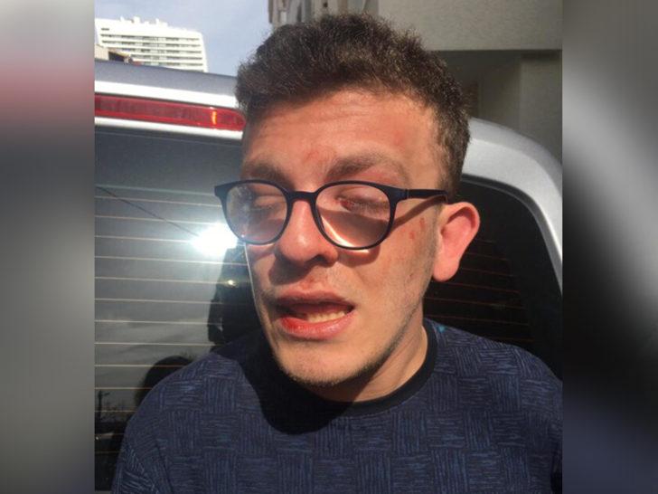 Avcılar'da bir kişi otizmli genci döverek hastanelik etti G4