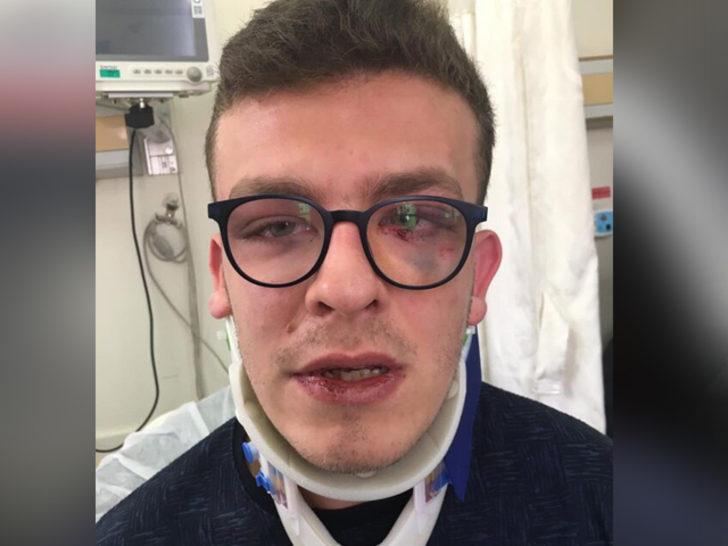 Avcılar'da bir kişi otizmli genci döverek hastanelik etti G5