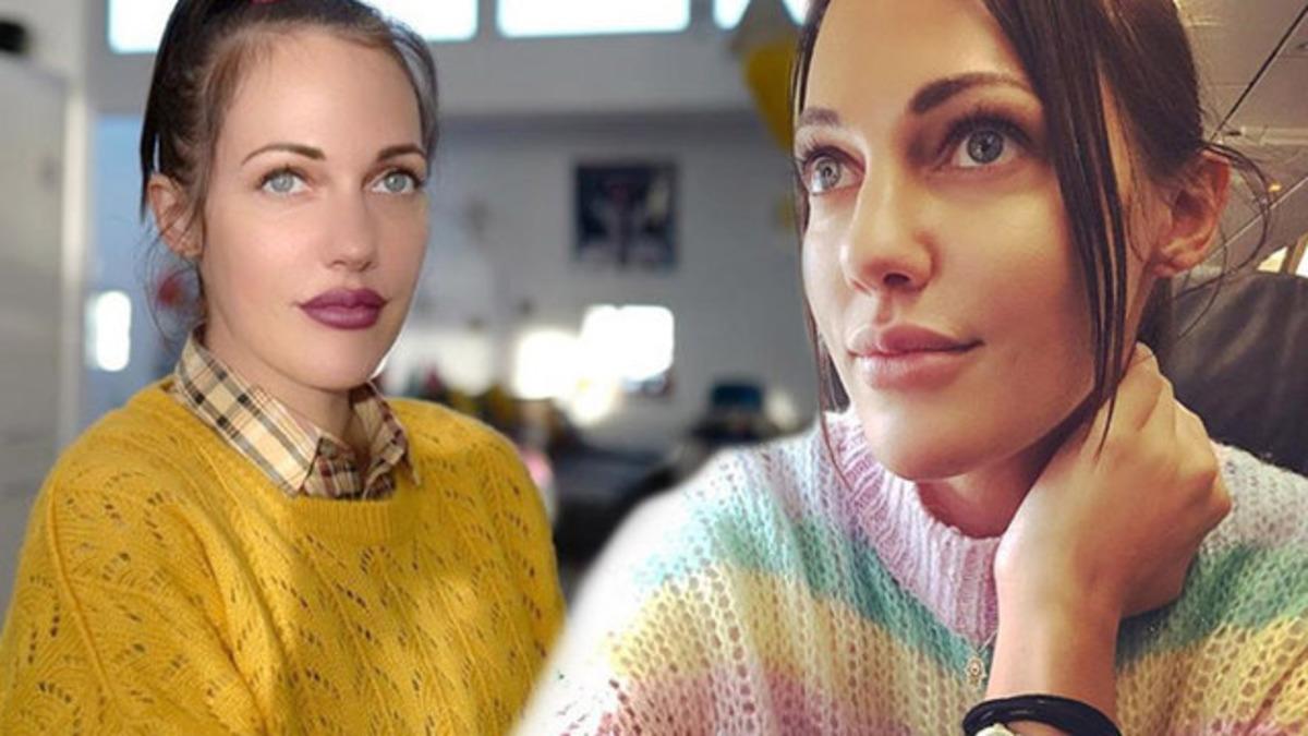 Meryem Uzerli'nin estetik itirafı! İşte değişimi