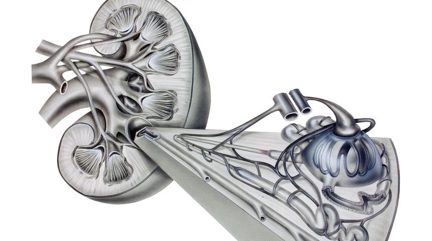 Kronik böbrek hastalığı 2040 yılının en ölümcül sağlık sorunu olacak!