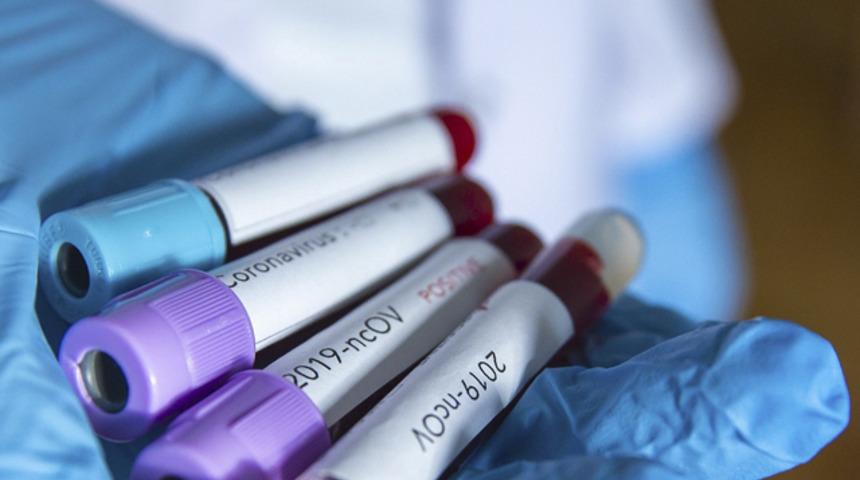 Bill Gates'ten koronavir&uuml;s a&ccedil;ıklaması: Endişe verici!