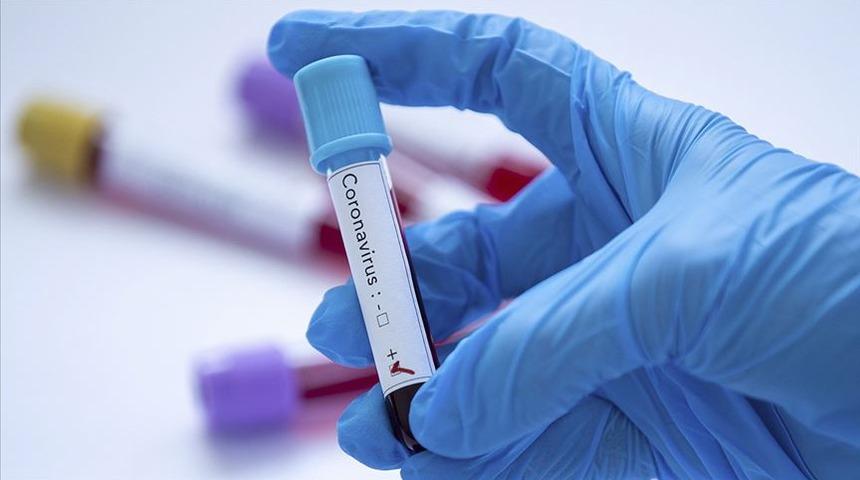 KKTC'de koronavir&uuml;s vaka sayısı arttı