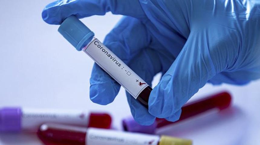 İşte koronavir&uuml;s ile ilgili doğru bilinen yanlışlar