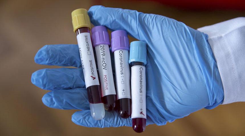 Kazakistan'da koronavirüs nedeniyle olağanüstü hal ilan edildi 