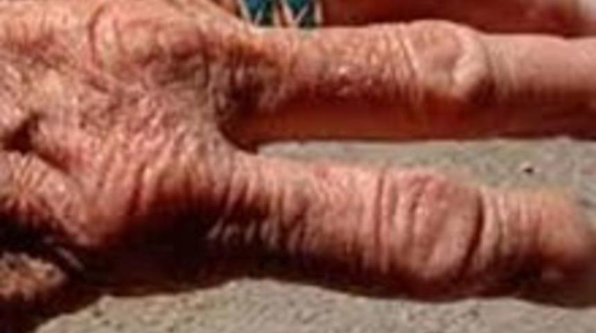 117 Yaşında Hala Sağlıklı