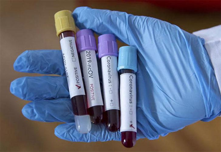 Koronavirüsün ortaya çıktığı Çin'de ilk kez yeni bir vaka görülmedi