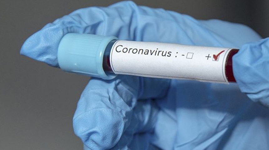 T&uuml;rk bilim insanı a&ccedil;ıkladı! Koronavir&uuml;s i&ccedil;in aşıda anlaşma sağlandı