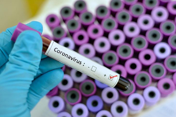 SIKÇA SORULAN SORULAR: KORONAVİRÜS TANISI NASIL KONULUR?