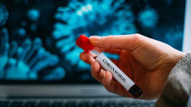 Kısa sürede çok sayıda analiz yapabilecek Kovid-19 test kiti geliştirildi