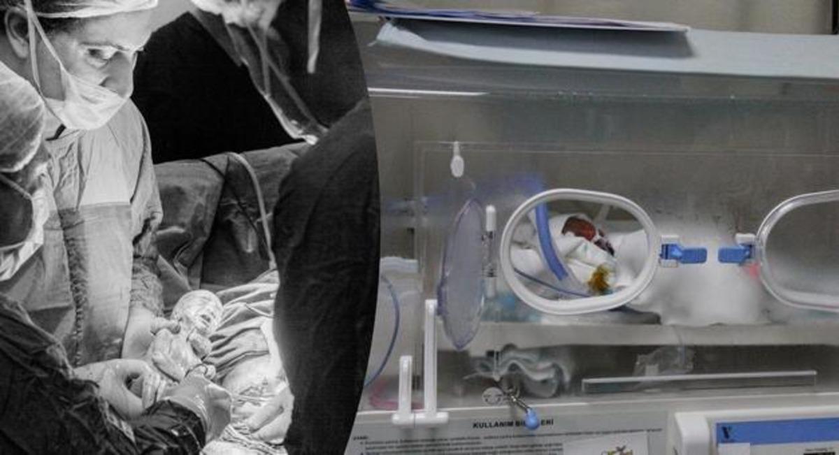 Mersin&rsquo;de altız bebek mutluluğu! D&uuml;nyada eşine &ccedil;ok az rastlanıyor