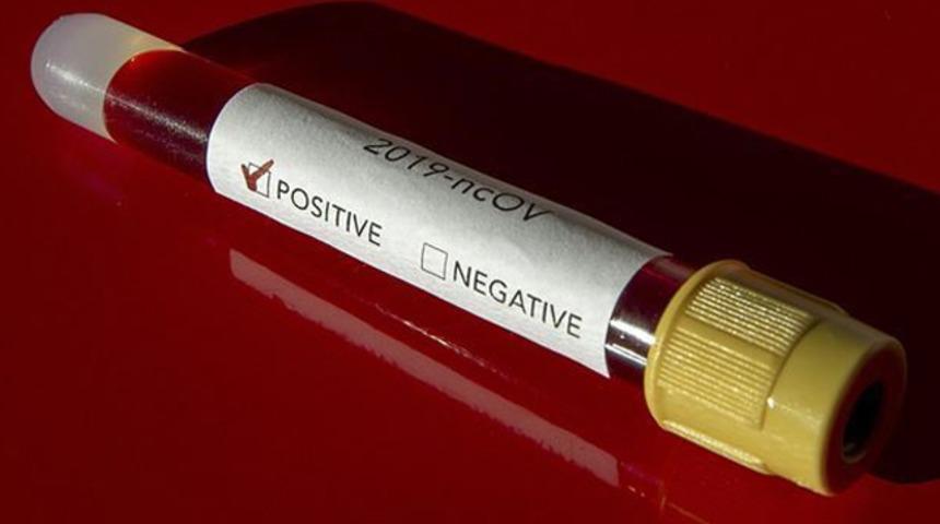 İşte Türkiye'de koronavirüs ile ilgili alınan önlemler! 