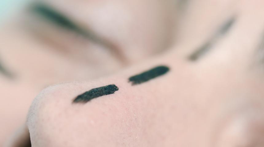 Erkeklerde burun estetiğinde nelere dikkat edilmeli?