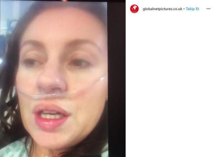 Koronavirüse yakalanan kadın: Ciğerlerimde cam varmış gibi hissediyorum G5