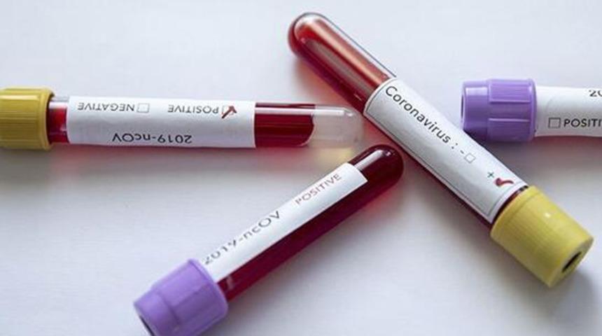 Koronavir&uuml;s ile ilgili dikkat &ccedil;eken araştırma! İşte en g&uuml;venilir kaynak